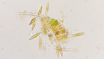 Kolonie rozsivek druhu Fragilaria, snímek z mikroskopu – Ekky Ilham / Shutterstock