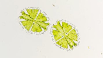 Stonásobně zvětšené krásivky (Micrasterias) – Ekky Ilham / Shutterstock