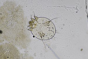 Zákožka svrabová (Sarcoptes scabiei) pod mikroskopem – Blossom Tomorrow / Shutterstock