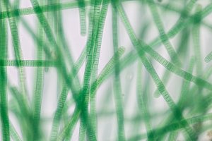 Cyanobakterie z rodu Oscillatoria pod mikroskopem – Rattiya Thongdumhyu / Shutterstock