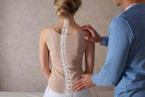 Skolióza – Albina Gavrilovic / Shutterstock