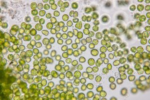 Chlorella, řasa pod mikroskopem – Rattiya Thongdumhyu / Shutterstock