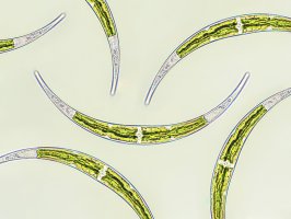 Řasa vřetenovka (Closterium) pod mikroskopem – Elif Bayraktar / Shutterstock