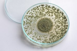 Kulturní plíseň kropidlák rýžový (Aspergillus oryzae), známá pod názvem plíseň koji – Rattiya Thongdumhyu / Shutterstock