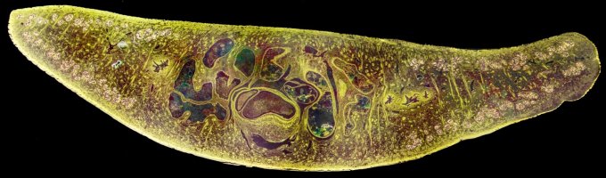 Fasciola hepatica – Kateryna Kon / Shutterstock